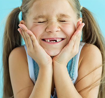 Tooth girl with missing front teeth after tooth extractions