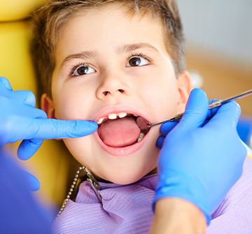 Child's smile examined after frenectomy treatment