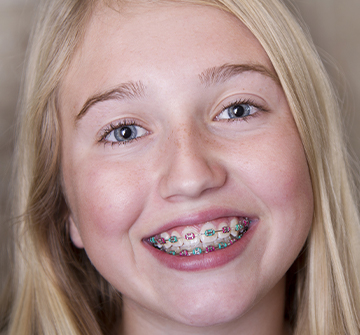 Preteen girl with braces