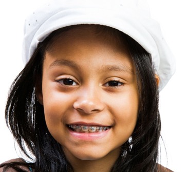 A little girl wearing a white hat and smiling, showing off her metal braces