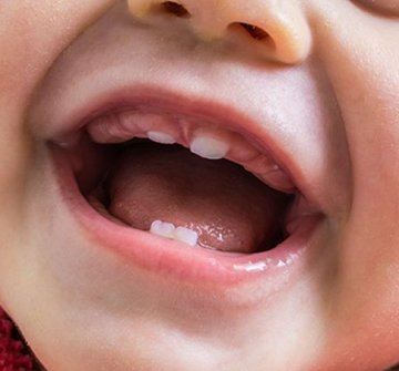 a closeup of an infant’s emerging baby teeth
