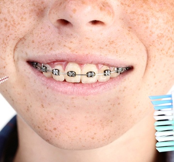 Closeup of child caring for their braces in Randolph with toothbrush and flossing tool