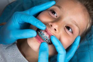 a child with braces smiling